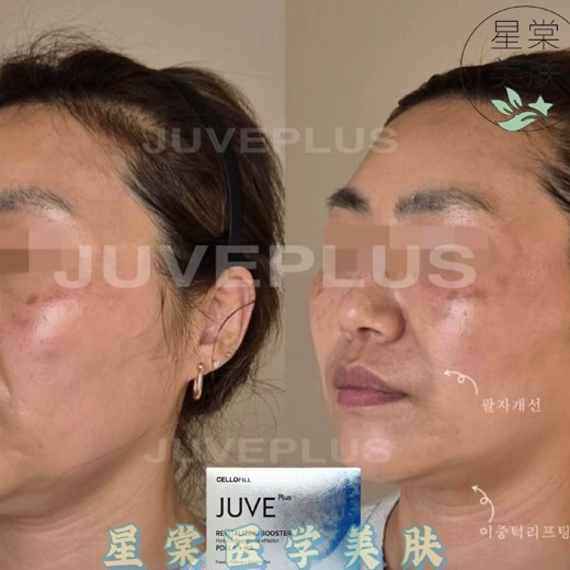 女性必备护肤课，带你轻松养出逆龄好肌肤封面