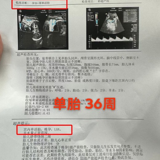 马士兵教育-深入理解TCP-面试20问封面